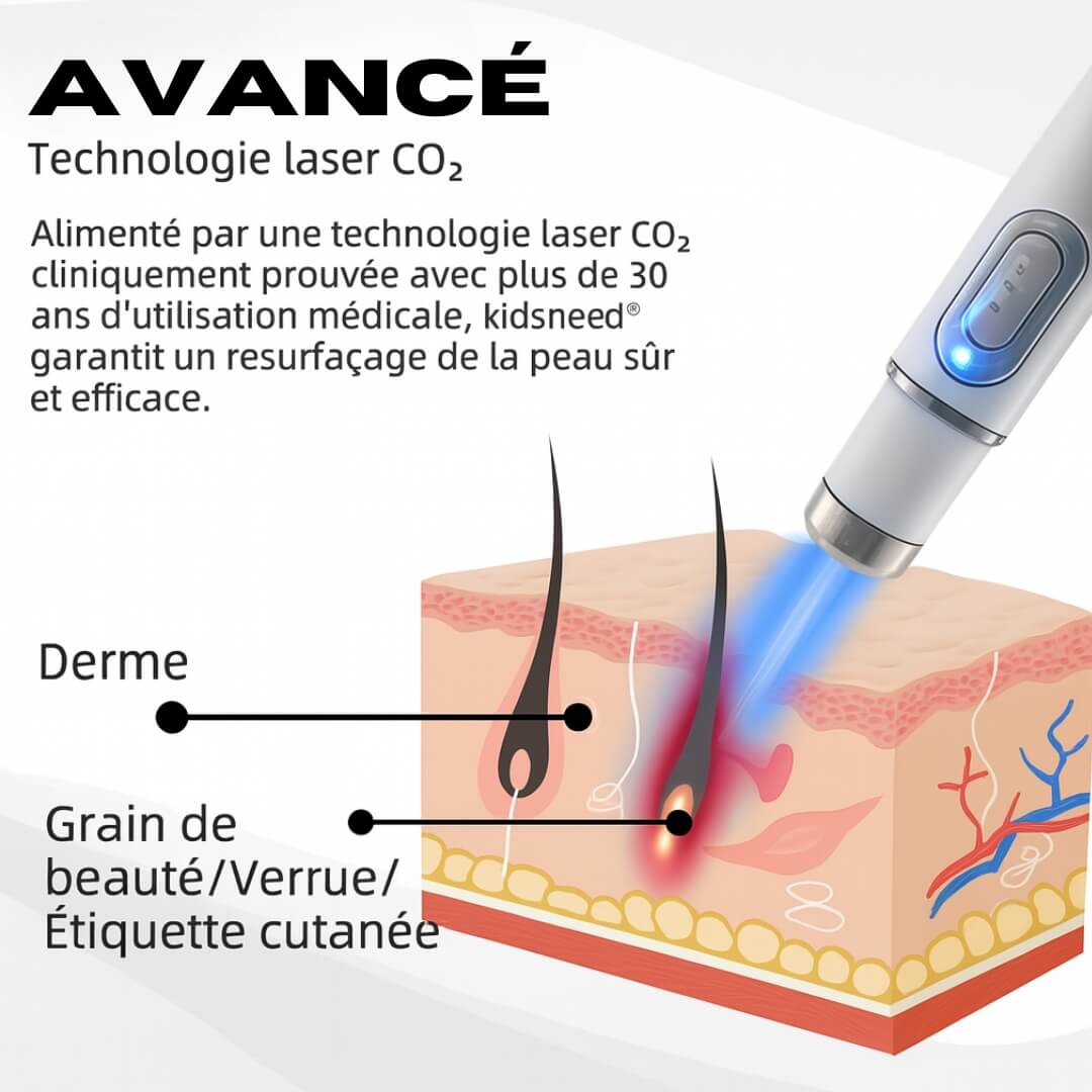 Stylo Laser Kidsneed® non-invasif – Élimine Verrues, Grains de Beauté, Tâches & Imperfections